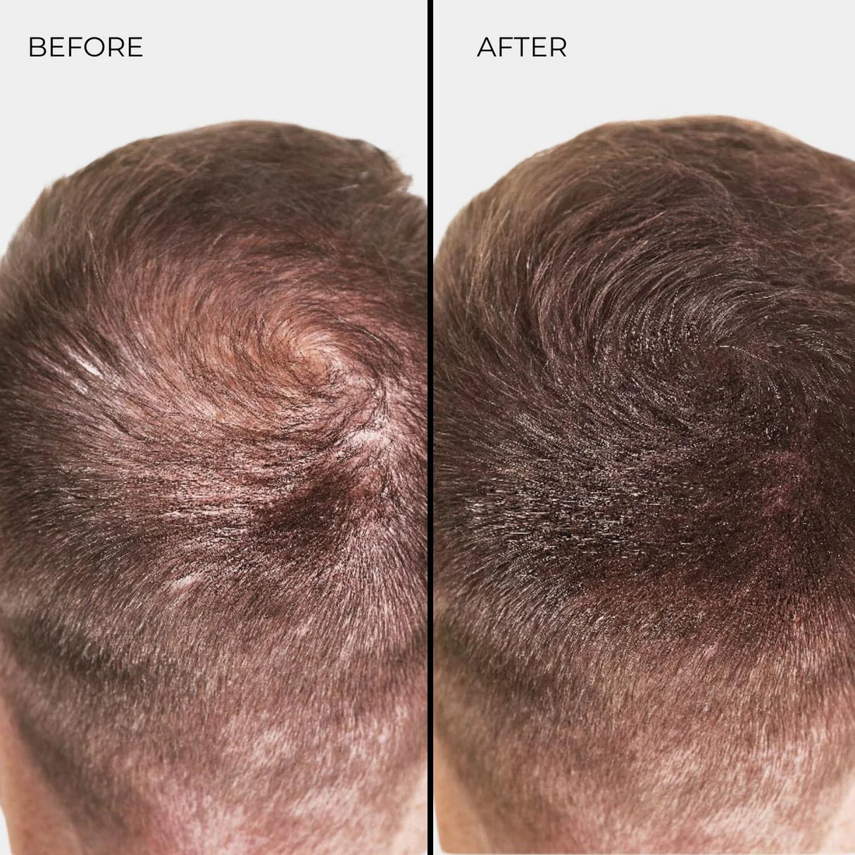 ألياف تكثيف الشعر نانوجين بني فاتح 15g