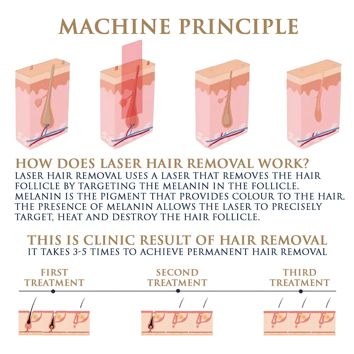 Skin Monarch Quantum Pro Diode & Picosecond Laser - BVShop