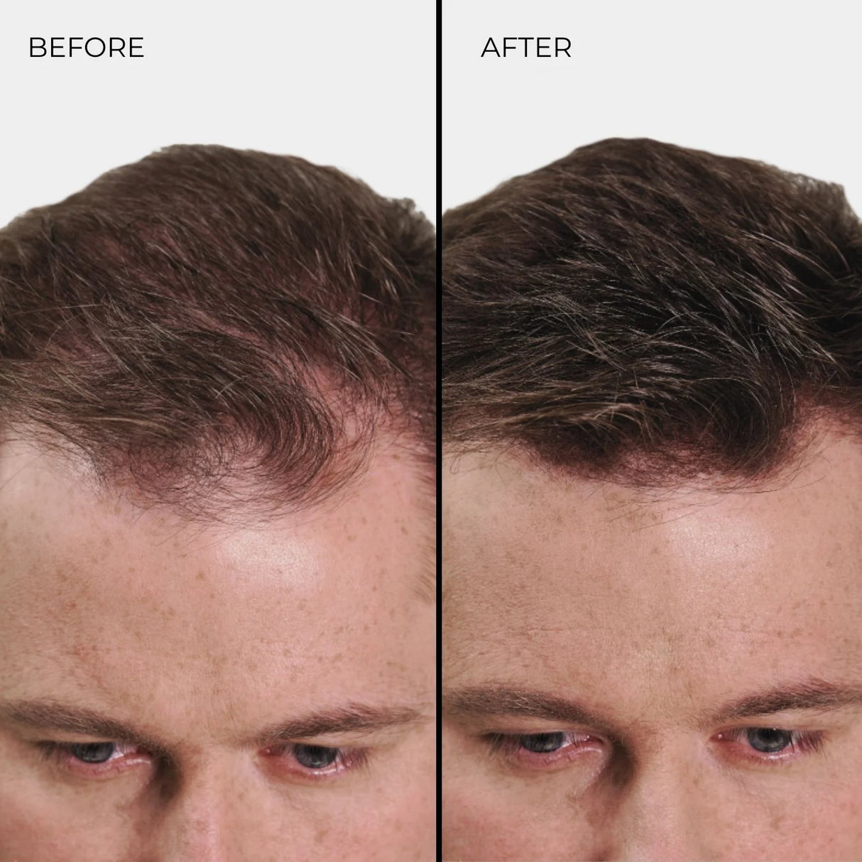 ألياف نانوغين لتكثيف الشعر بلون أشقر فاتح